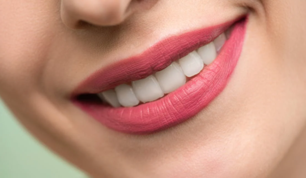 Exploring the Benefits of Professional Teeth Whitening